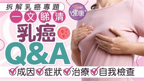 胸部長痣乳癌|拆解乳癌專題｜乳癌症狀/治療/篩查/手術/特徵/前兆/成 